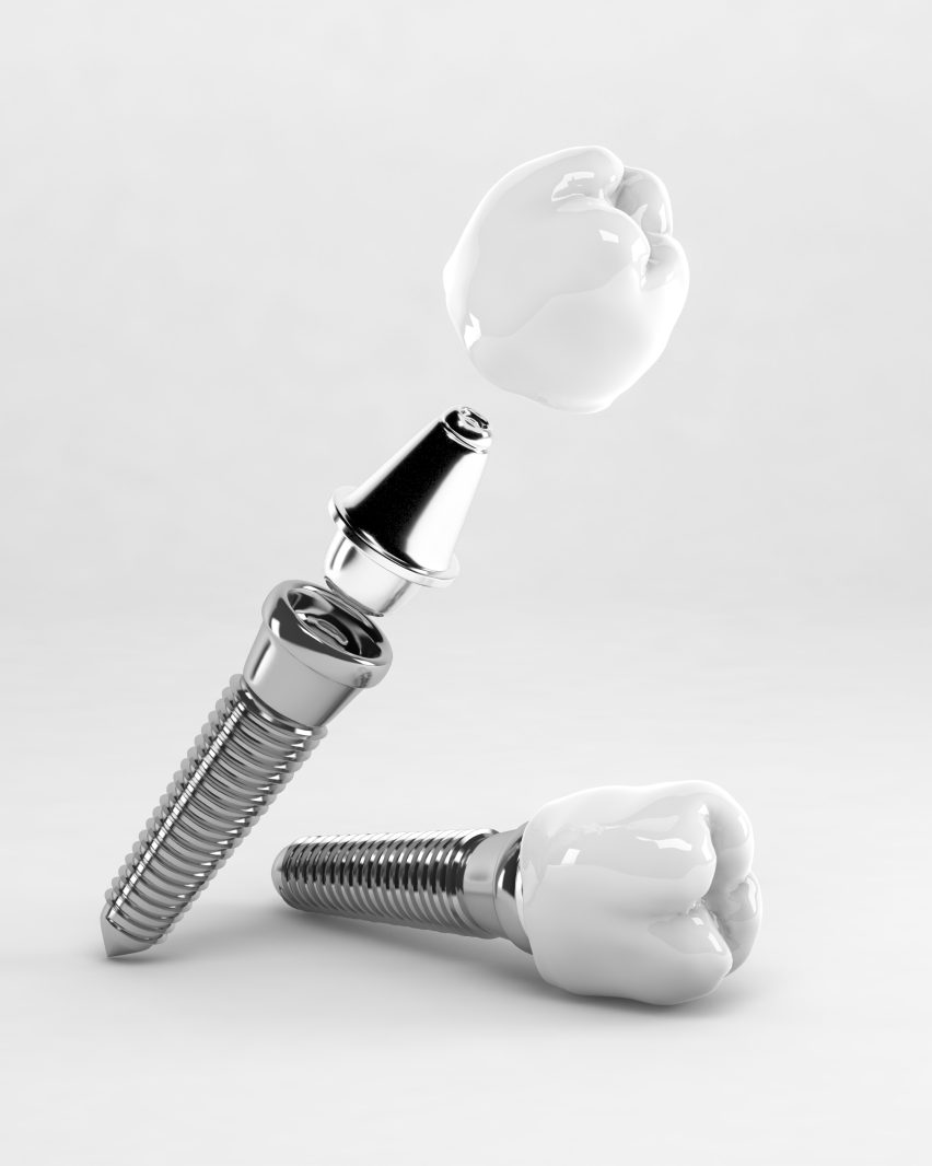 Detail of a false tooth implant; 3D; 3D Illustration